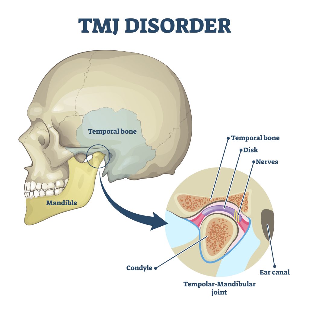 your-guide-to-tmj-disorder-encino-san-fernando-valley-ca